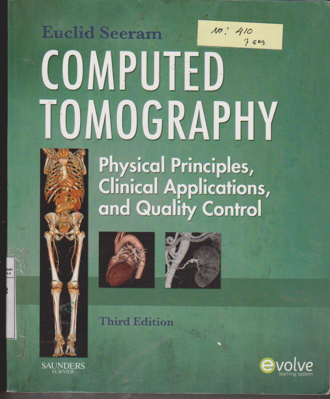 Computed Tomography physical princiles,Clinical Aplication and Quality Control