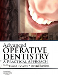 Advanced operative dentistry: A Pratical Approach