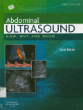 Abdominal Ultrasound: How, Why and When - Third Edition