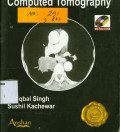 Computed Tomography : Anshan Gold Standard Mini Atlas Series