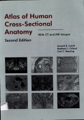 Atlas of Human Cross-Sectional : Anatomy with CT and MR Images 2nd ed.