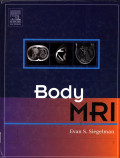 Body MRI