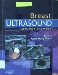 Breast Ultrasound How, why and When
