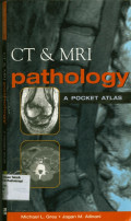 CT & MRI pathology  : A Pocket Atlas