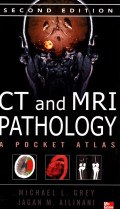 CT and MRI Pathology A Pocket Atlas