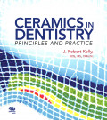 Ceramics in Dentistry  Principles and Practice