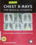 Chest X - Rays For Medical Students