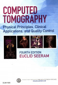 Computer Tomography: Physical Principles, Clinical Applications, and Quality Control