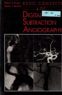 Basic Concepts of DigitalSubtraction Angiography