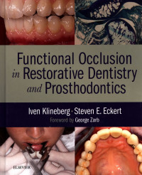 Functional Occlusion in Restorative Dentistry and Prostodontics