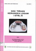 Gigi Tiruan Kerangka Logam (GTSL II) : Serial Buku Ajar No. 004.TG