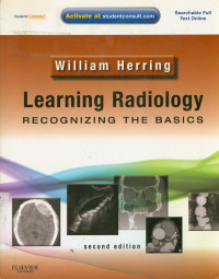 Learning Radiology: Recognizing The Basics