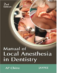 Manual of Local Anesthesia in Dentistry