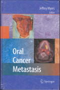 Oral Cancer Metastasis