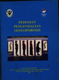 Pedoman Pengendalian Osteoporosis