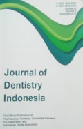 Journal of Dentistry Indonesia Vol. 22 No.3 Tahun 2015