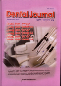 Dental Journal (Majalah Kedokteran Gigi): Vol. 47-49  Tahun 2014 - 2016