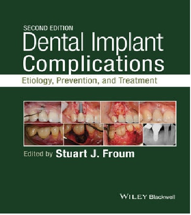 Dental Implant  Etiology, Prevention, and Treatment